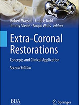 Extra-Coronal Restorations: Concepts and Clinical Application 2nd Edition