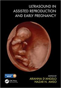 Ultrasound in Assisted Reproduction and Early Pregnancy 1st Edition