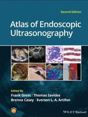 Atlas of Endoscopic Ultrasonography 2nd Edition