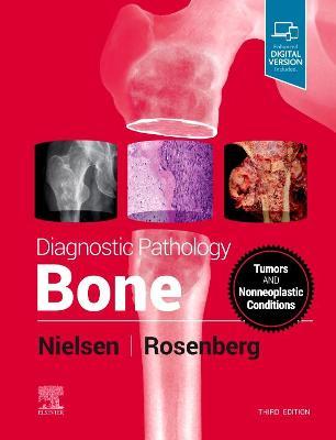 Diagnostic Pathology: Bone 3rd Edition - 9780323765336