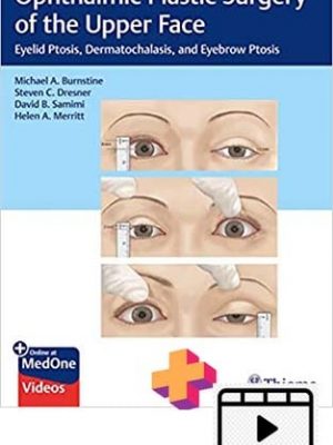 Ophthalmic Plastic Surgery of the Upper Face + videos