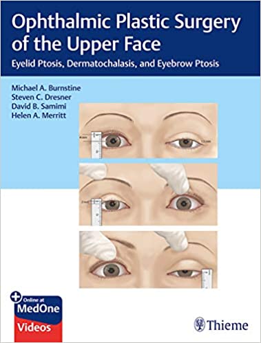 Ophthalmic Plastic Surgery of the Upper Face - 9781626239210