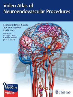 Video Atlas of Neuroendovascular Procedures - 9781684201181