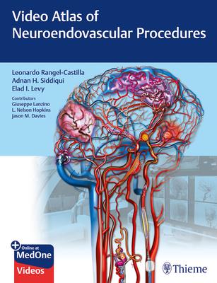 Video Atlas of Neuroendovascular Procedures - 9781684201181