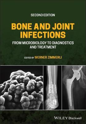 Bone and Joint Infections: From Microbiology to Diagnostics and Treatment 2nd Edition - 9781119720652