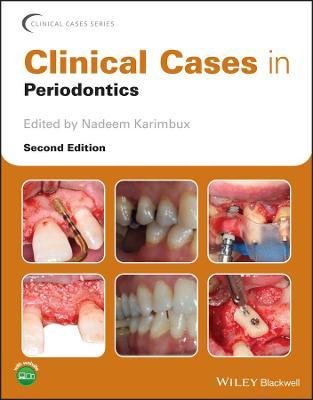 Clinical Cases in Periodontics 2nd Edition - 9781119583950