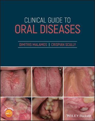 Clinical Guide to Oral Diseases - 9781119328117