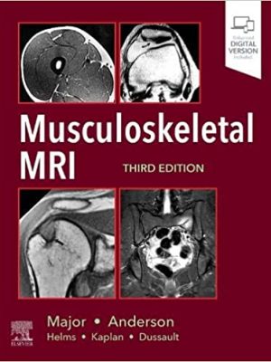 Musculoskeletal MRI 3rd Edition - 9780323415606