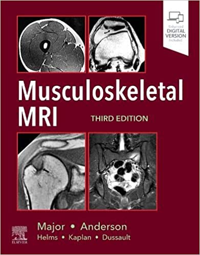 Musculoskeletal MRI 3rd Edition - 9780323415606