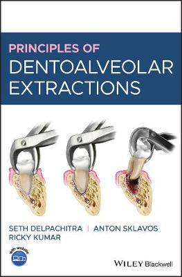 Principles of Dentoalveolar Extractions 1st Edition - 9781119596400