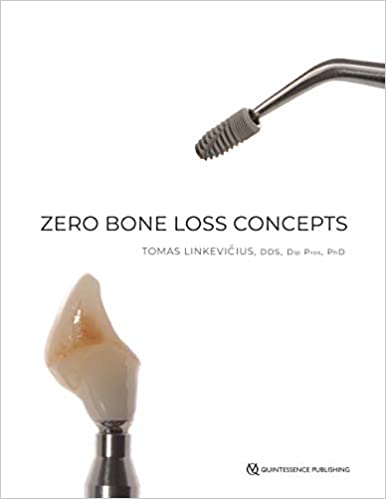 Zero Bone Loss Concepts 1st Edition - 9780867157994