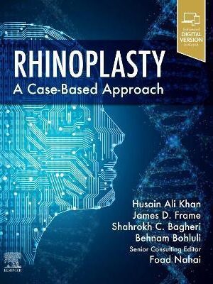 Rhinoplasty: a Case-based approach - 9780323697750