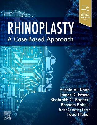 Rhinoplasty: a Case-based approach - 9780323697750