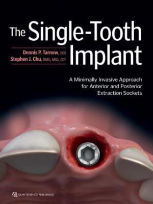 The Single-Tooth Implant: A Minimally Invasive Approach for Anterior and Posterior Extraction Sockets - 9780867157710