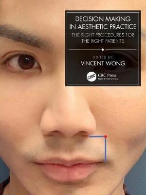 Decision Making in Aesthetic Practice: The Right Procedures for the Right Patients - 9780367769802