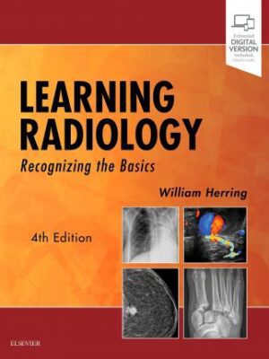 Learning Radiology: Recognizing the Basics 4th Edition - 9780323567299