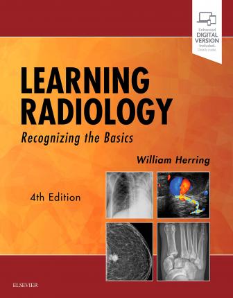 Learning Radiology: Recognizing the Basics 4th Edition - 9780323567299