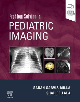 Problem Solving in Pediatric Imaging - 9781437726121