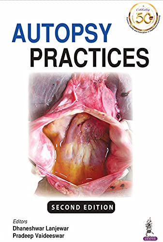 Autopsy Practices 2nd Edition - 9789389587043
