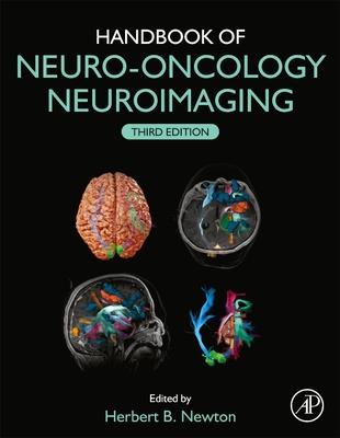 Handbook of Neuro-Oncology Neuroimaging 3rd Edition - 9780128228357