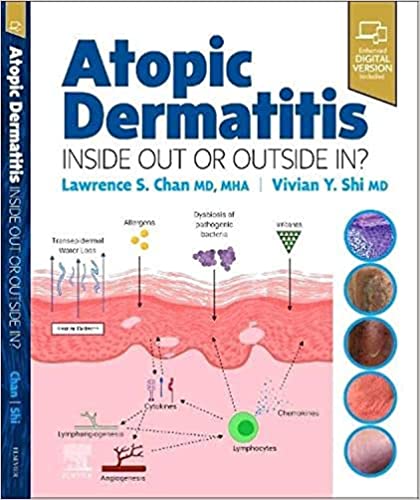 Atopic Dermatitis: Inside Out or Outside In - 9780323847445