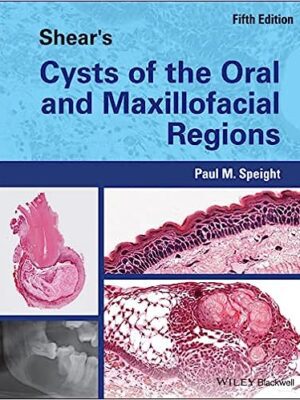 Shear's Cysts of the Oral and Maxillofacial Regions 5th Edition - 9781119354994