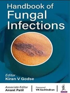 Handbook of Fungal Infections - 9789354659546