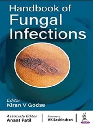 Handbook of Fungal Infections - 9789354659546